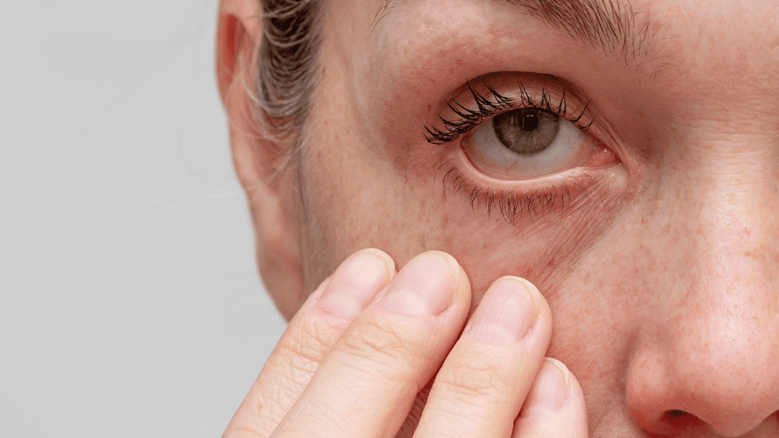 Utjecaj zagađenja na oči: Više od običnog crvenila